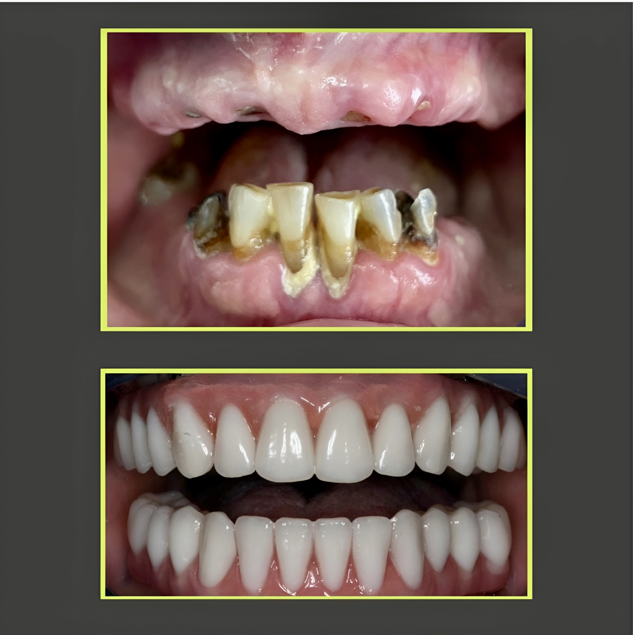 Case 02: Two stacked mouth photographs in green borders on a dark background.